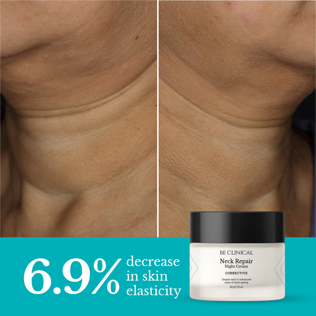 Neck Repair Skin Tightening Night Cream